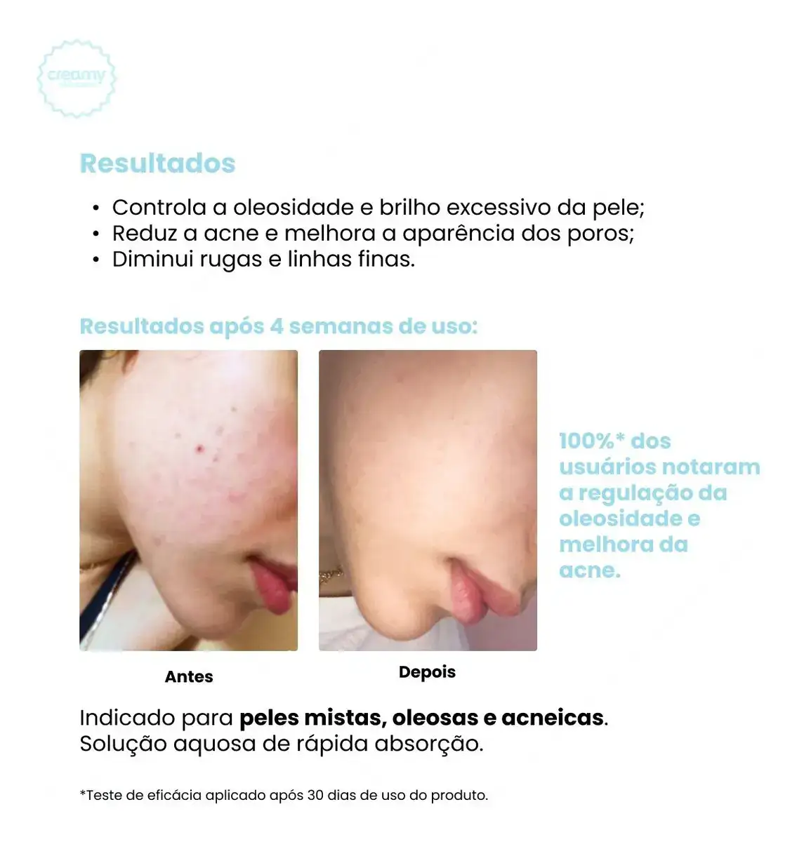 Creamy skincare ácido salicílico 90ml | tônico antioleosidade, rápida absorção, diminui o brilho excessivo, diminui os cravos | peles mistas, oleosas, noturno e diurno - Imagem 4