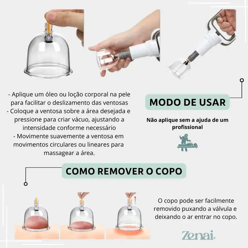 Kit 18 Ventosas Com Bomba Ventosaterapia Massoterapia Zenai - Imagem 2